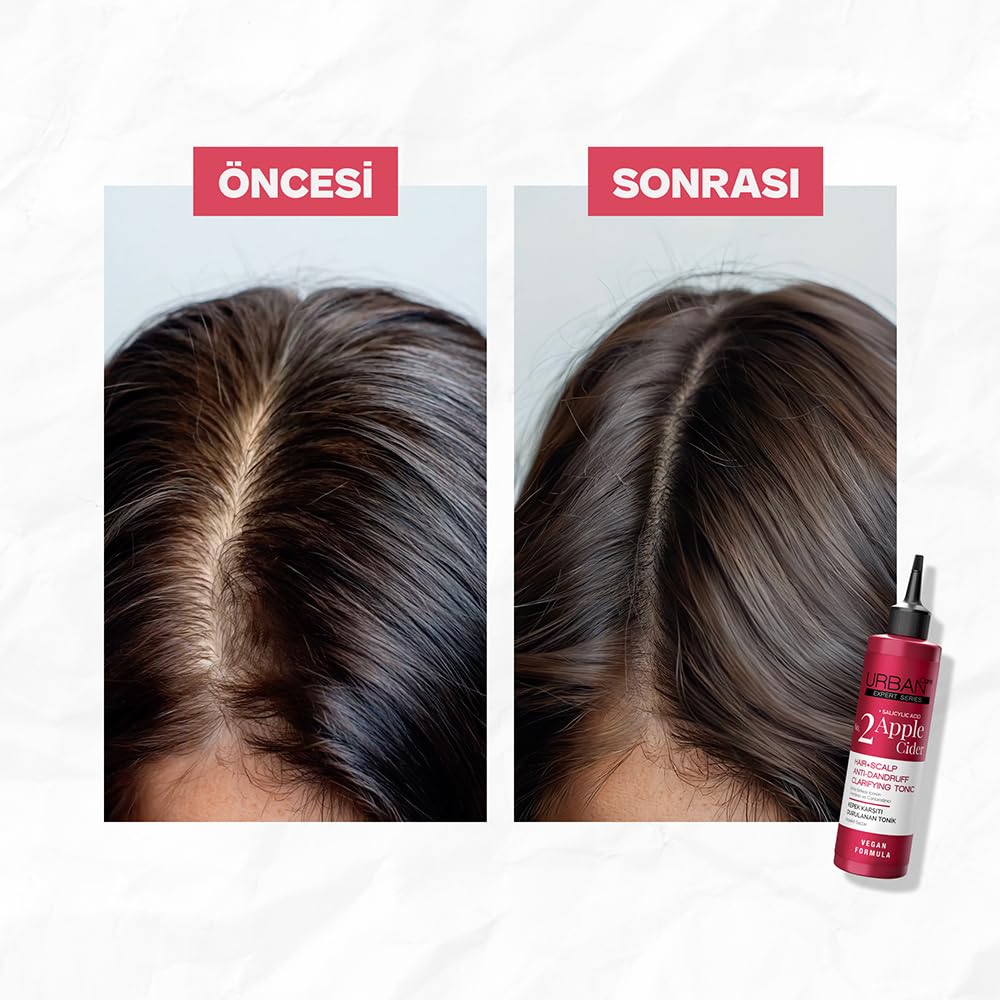 Urban Care Apple Cider Anti-Dandruff Hair Tonic 200ml / 6.76fl.oz